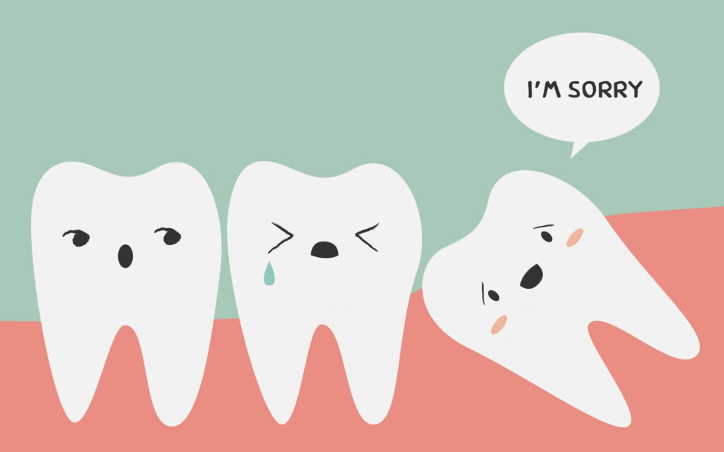 Can wisdom teeth cause headache